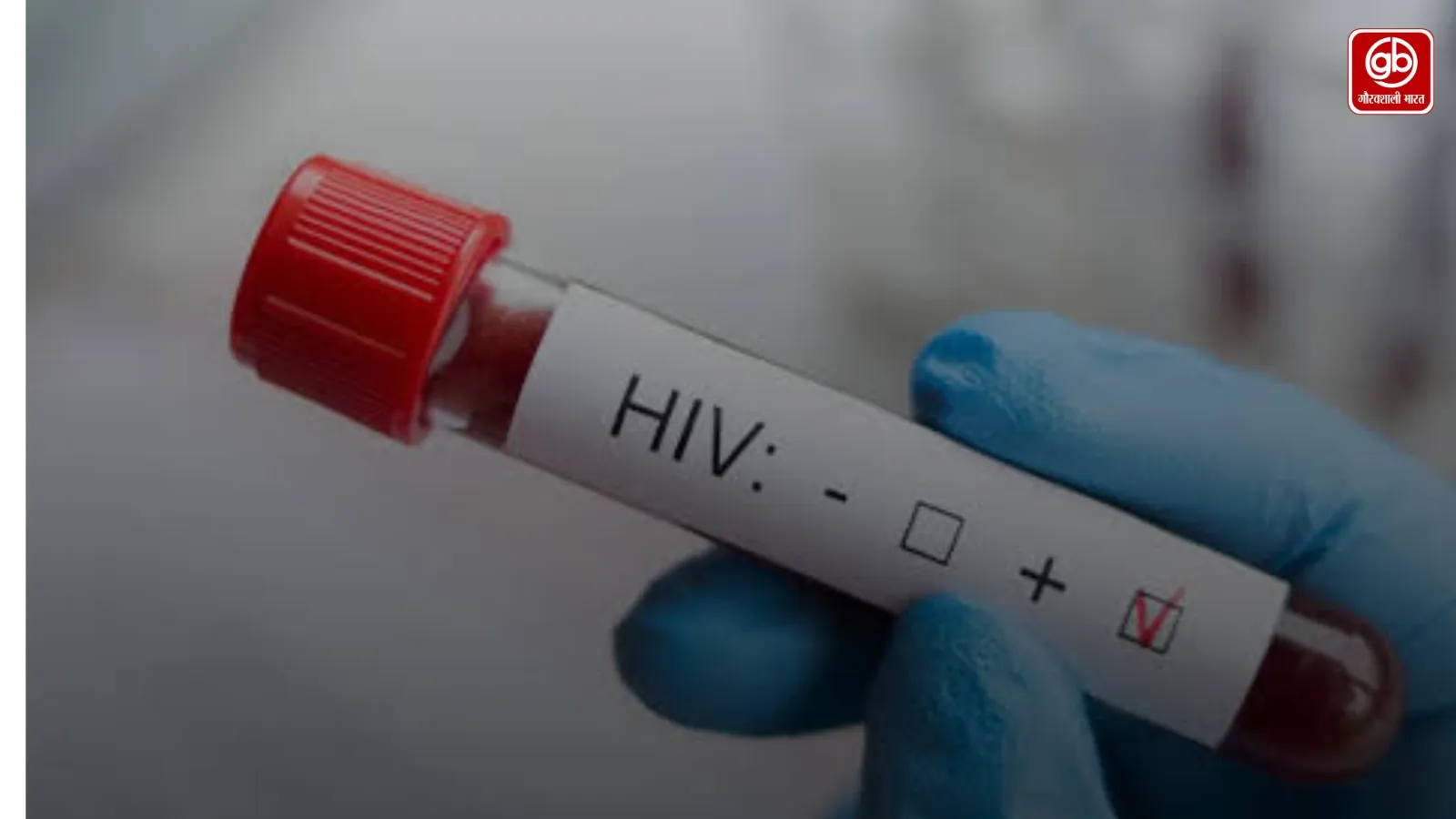 HIV की जानकारी छिपाने का आरोप, पति समेत ससुराल पक्ष पर मुकदमा